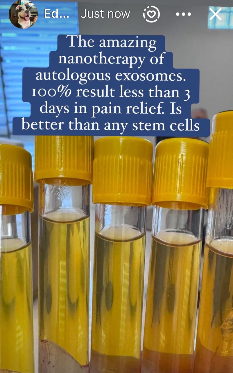 Exosomes ready